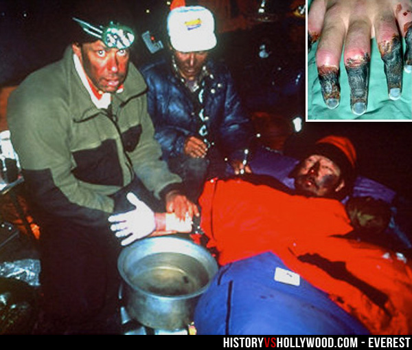 Dr. Ken Kamler Treating Beck Weathers Frozen Hand